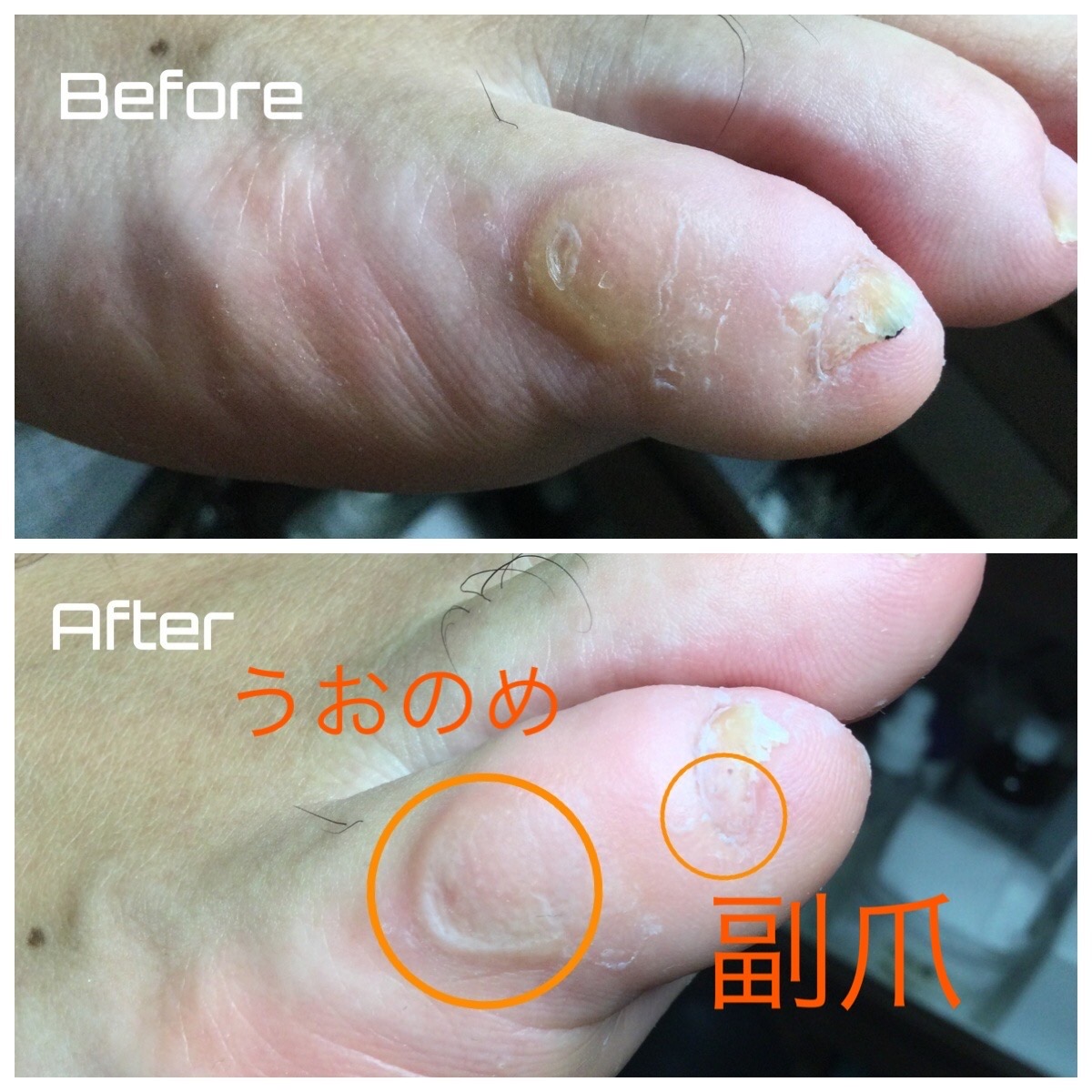 小指の痛み それ爪じゃないかも 用賀のネイル まつ毛エクステ ドクターネイル Cure プラスキュア 用賀店